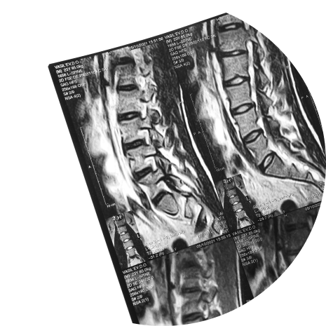 MRI scans of a human spine displayed in multiple frames, showing detailed views of vertebrae and spinal discs in grayscale for medical imaging applications.