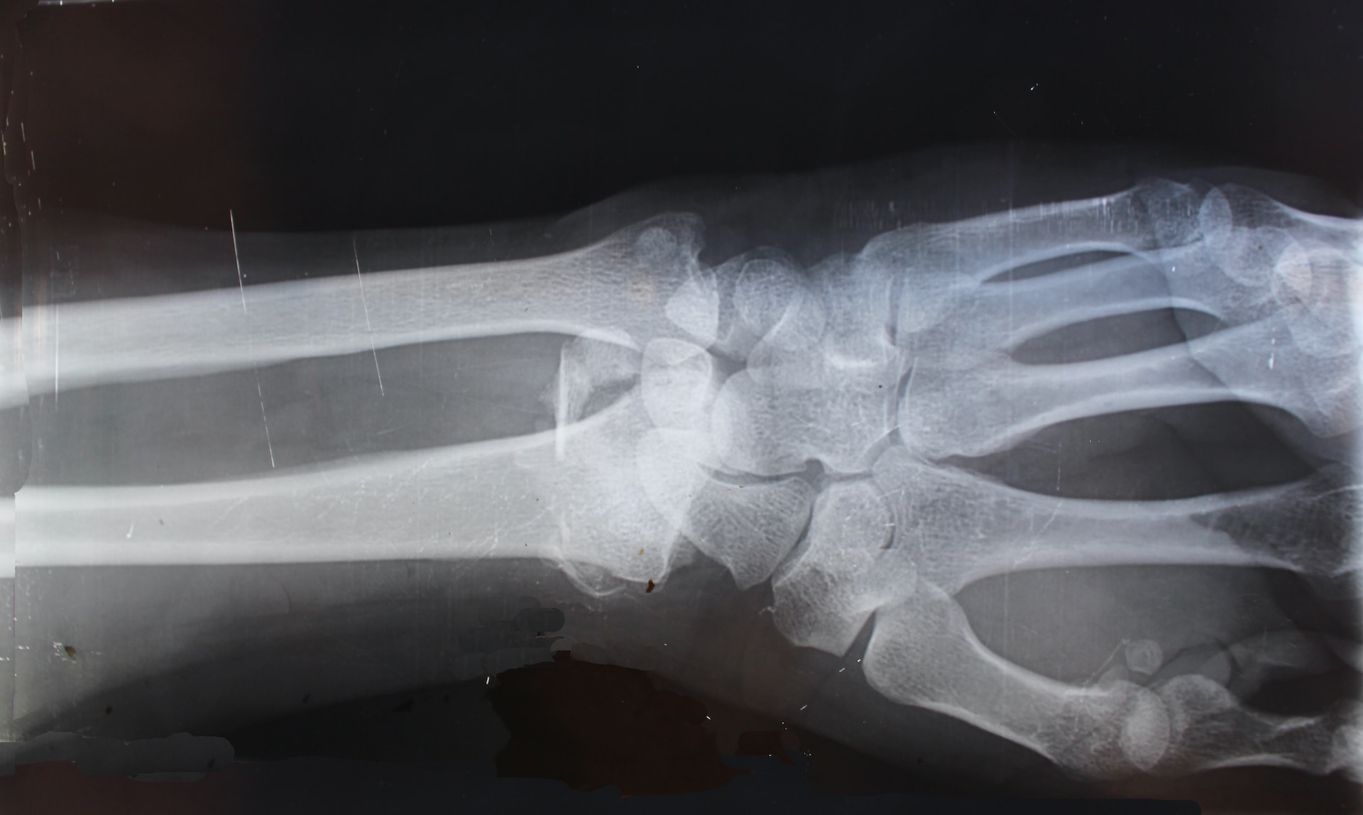 Service The Role and Importance of X-Rays in Modern Medicine