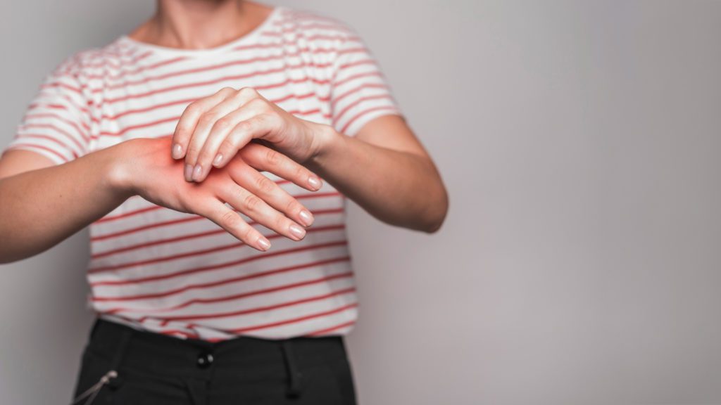 Woman holding her hand that is in pain with arthritis.